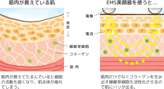 EMS機能の説明